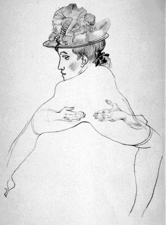 Литография Bellmer - La vita