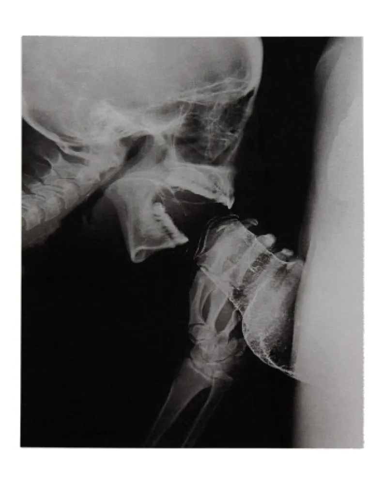 Иллюстрированная Книга Delvoye - Sexrays