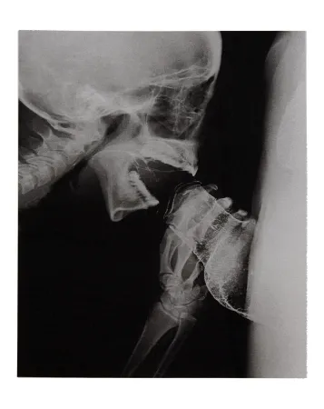 Иллюстрированная Книга Delvoye - Sexrays