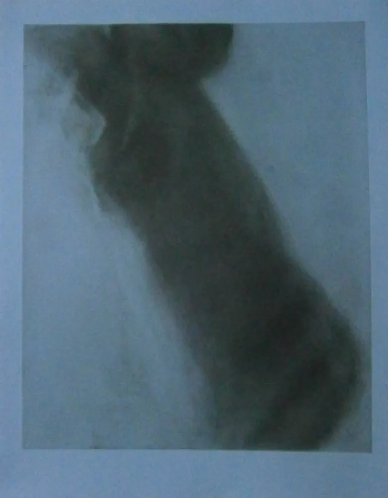 Офорт Garache - Bleue