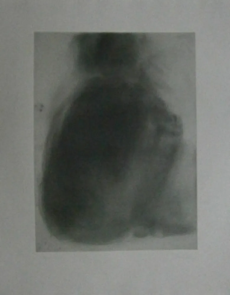 Офорт Garache - Tourette