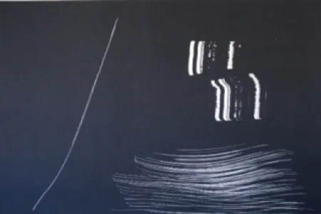 Литография Hartung - Farandole 9