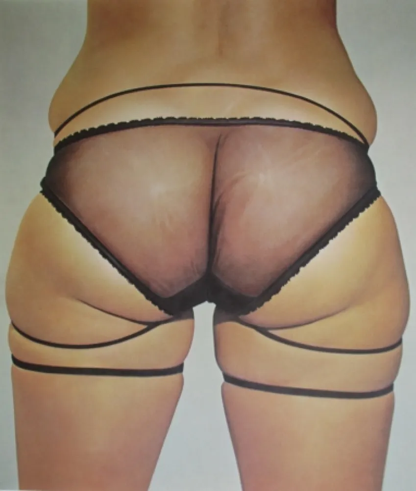 Литография Kacere - Loretta 