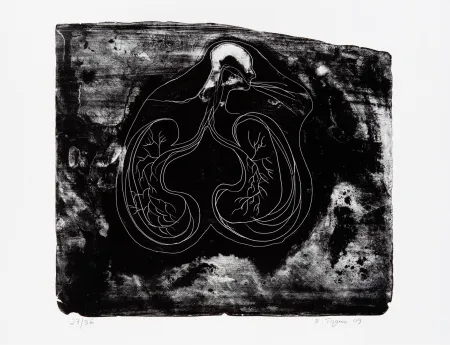 Литография Toguo - Reasons to love